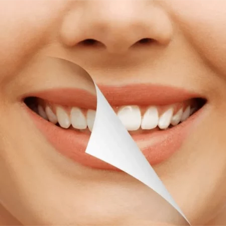 Soins Dentaires